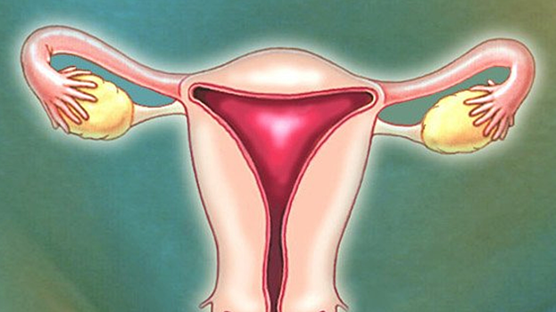 В России предложили вместо удаления кист яичников алкоголизировать их
