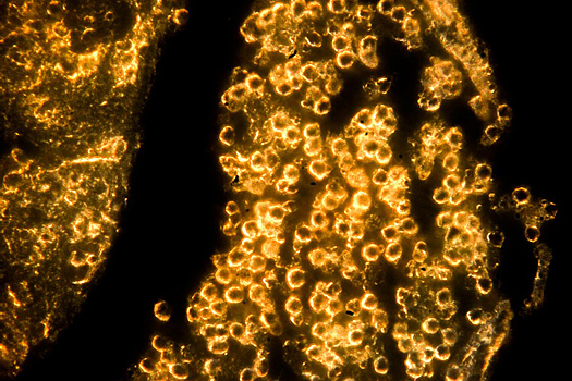 Создана безопасная альтернатива золотым наночастицам для лечения рака