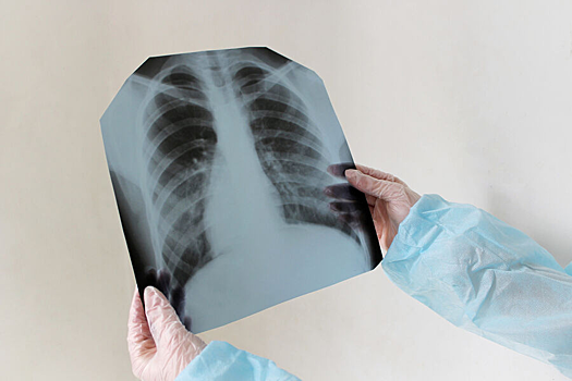 Ученые выяснили, как иммунитет сдерживает «спящий» туберкулез