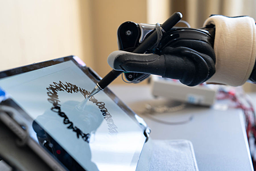 В России создали первый модуль локтя для бионических протезов