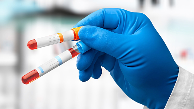 Обнаружен простой способ заранее выявить развитие деменции